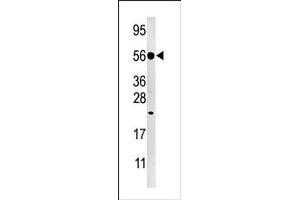 anti-Dual Specificity Phosphatase 8 (DUSP8) (C-Term) antibody
