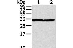 Western Blot analysis of A375 cell using STX3 Polyclonal Antibody at dilution of 1:400 (STX3 anticorps)