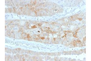 Formalin-fixed, paraffin-embedded human Kidney stained with ROR2 Mouse Monoclonal Antibody (ROR2/1912).