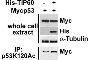 Western Blotting (WB) image for anti-Tumor Protein P53 (TP53) (acLys315) antibody (ABIN3201007) (p53 anticorps  (acLys315))