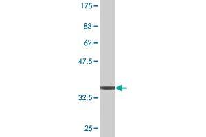 Western Blot detection against Immunogen (36. (ERK1 anticorps  (AA 279-379))