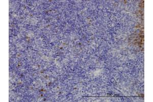 Immunoperoxidase of monoclonal antibody to CLIC3 on formalin-fixed paraffin-embedded human tonsil.