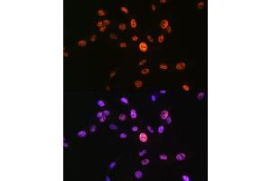 Immunofluorescence analysis of NIH-3T3 cells using Phospho-Histone H3-S10 Rabbit pAb (ABIN7267687) at dilution of 1:100 (40x lens).
