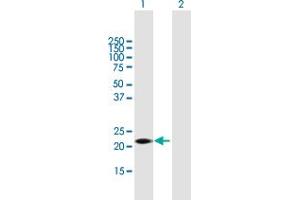 Western Blot analysis of GSTK1 expression in transfected 293T cell line by GSTK1 MaxPab polyclonal antibody. (GSTK1 anticorps  (AA 1-226))