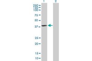 Western Blot analysis of HDAC11 expression in transfected 293T cell line by HDAC11 MaxPab polyclonal antibody. (HDAC11 anticorps  (AA 1-347))
