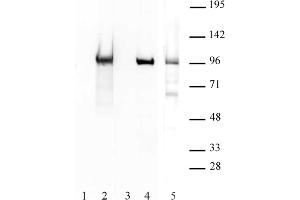 BORIS / CTCFL antibody (pAb) tested by Western blot. (CTCFL anticorps  (N-Term))