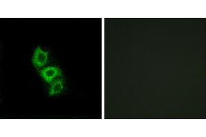 Peptide - +Immunohistochemistry analysis of paraffin-embedded human liver carcinoma tissue using APOL5 antibody. (Apolipoprotein L 5 anticorps)