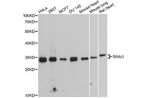 Western blot analysis of extracts of various cell lines, using SNAI1 antibody (ABIN4905248) at 1:1000 dilution. (SNAIL anticorps)