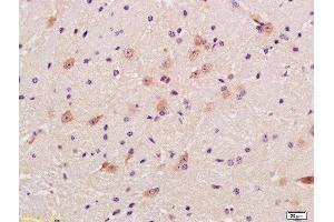 anti-GAD65+GAD67 (AA 351-450) antibody