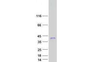 Validation with Western Blot