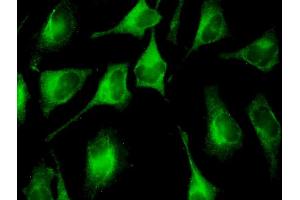 Immunofluorescence of monoclonal antibody to FAU on HeLa cell.