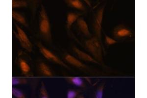 Immunofluorescence analysis of U-2 OS cells using UBE2S Polyclonal Antibody at dilution of 1:100.