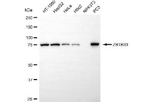 Western blotting analysis using ZBTB33 antibody (ABIN7800890).