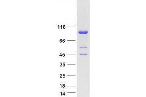 Validation with Western Blot