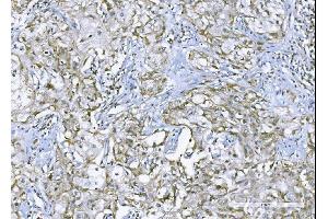 IHC analysis of TNF alpha using anti-TNF alpha antibody (ABIN4886747).