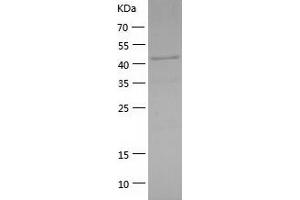 Western Blotting (WB) image for Inhibitor of kappa Light Polypeptide Gene Enhancer in B-Cells, Kinase gamma (IKBKG) (AA 1-419) protein (His-IF2DI Tag) (ABIN7123433)