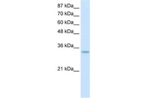 Western Blotting (WB) image for anti-Protein Kinase, Interferon-Inducible Double Stranded RNA Dependent Activator (PRKRA) antibody (ABIN2462150) (PRKRA anticorps)