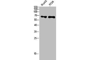 Western Blot analysis of hepg2, NT28 cells using Antibody diluted at 500. (ZFP91 anticorps  (AA 401-450))