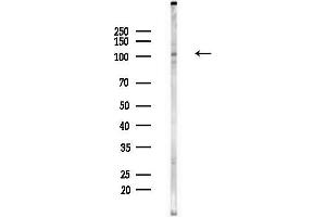 anti-rho GTPase Activating Protein 17 (ARHGAP17) (Internal Region) antibody