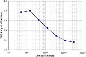 anti-Lysine (K)-Specific Demethylase 5B (KDM5B) (Internal Region) antibody