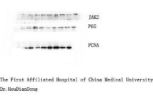 Western Blot (WB) analysis: Please contact us for more details. (NF-kB p65 anticorps)