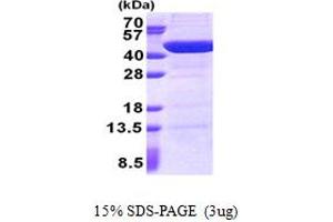 SDS-PAGE (SDS) image for UBX Domain Protein 2B (UBXN2B) (AA 1-331) protein (His tag) (ABIN5853030) (UBXN2B Protein (AA 1-331) (His tag))