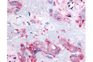 Anti-RARB antibody IHC of human intermediate trophoblasts.