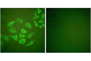 Immunofluorescence analysis of HepG2 cells, using MMP-10 Antibody. (MMP10 anticorps  (AA 361-410))