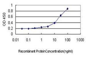 Detection limit for recombinant GST tagged STAU1 is approximately 0.