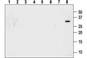 Western blot analysis using Anti-pro Antibody (ABIN7581927) (1:600):1.