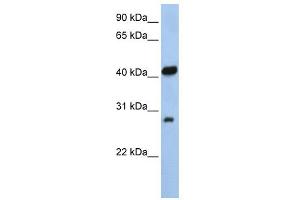 WB Suggested Anti-ZFAND3 Antibody Titration:  0.