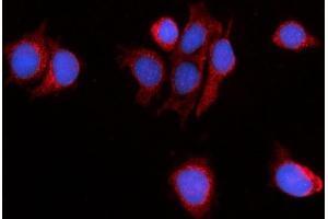 IF analysis of PDE4DIP using anti-PDE4DIP antibody (ABIN7602691).