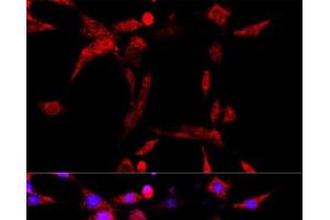 Immunofluorescence analysis of PC-12 cells using CYP1B1 Polyclonal Antibody at dilution of 1:100 (40x lens). (CYP1B1 anticorps)