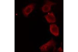 ABIN6276233 staining RAW264. (AVPR2 anticorps  (Internal Region))