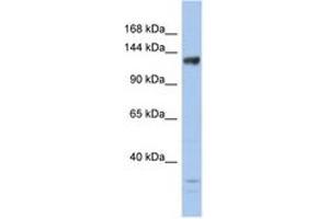 Image no. 1 for anti-Lysine (K)-Specific Demethylase 4B (KDM4B) (AA 359-408) antibody (ABIN6744254) (KDM4B anticorps  (AA 359-408))