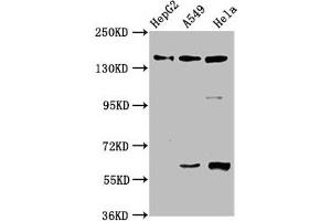 Western Blot Positive WB detected in: HepG2 whole cell lysate, A549 whole cell lysate, Hela whole cell lysate All lanes: NAIP antibody at 3. (NAIP anticorps  (AA 147-242))