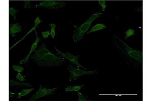 Immunofluorescence of monoclonal antibody to IRAK4 on HeLa cell.