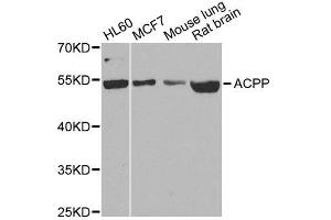 Western blot analysis of extracts of various cell lines, using ACPP antibody. (ACPP anticorps  (AA 40-300))