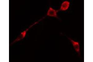 ABIN6274697 staining RAW264. (PHLDA1 anticorps  (N-Term))