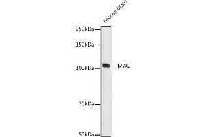 Western blot analysis of extracts of Mouse brain cells, using MAG antibody (ABIN7268718) at 1:1000 dilution. (MAG anticorps)