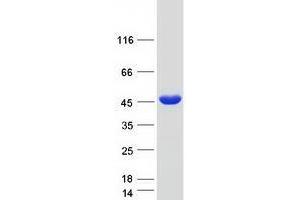 Validation with Western Blot