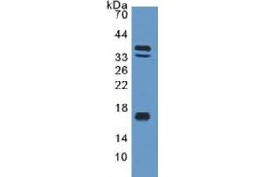 Mouse Capture antibody from the kit in WB with Positive Control: Sample Human Skeletal muscle lysate. (BNP Kit ELISA)
