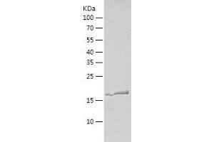 Western Blotting (WB) image for DIRAS Family, GTP-Binding RAS-Like 1 (DIRAS1) (AA 1-195) protein (His-IF2DI Tag) (ABIN7122675)