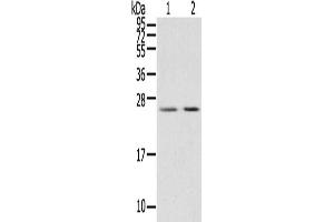 Gel: 12 % SDS-PAGE, Lysate: 40 μg, Lane 1-2: Human breast infiltrative duct tissue, Human placenta tissue, Primary antibody: ABIN7191460(MIG7 Antibody) at dilution 1/200, Secondary antibody: Goat anti rabbit IgG at 1/8000 dilution, Exposure time: 15 seconds (TOX4 anticorps)