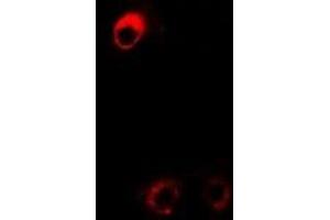 Immunofluorescent analysis of DDAH2 staining in Hela cells. (DDAH2 anticorps)