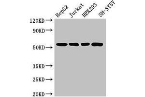 Western Blot Positive WB detected in: HepG2 whole cell lysate, Jurkat whole cell lysate, HEK293 whole cell lysate, SH-SY5Y whole cell lysate All lanes: DCTN4 antibody at 3. (Dynactin 4 anticorps  (AA 2-460))