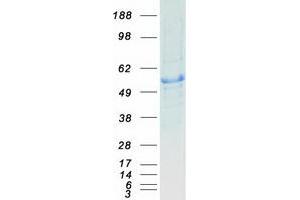 Validation with Western Blot