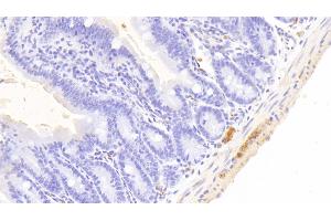 Detection of UCHL1 in Mouse Small intestine Tissue using Polyclonal Antibody to Ubiquitin Carboxyl Terminal Hydrolase L1 (UCHL1)