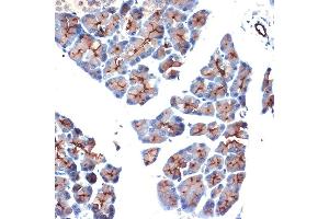 Immunohistochemistry of paraffin-embedded rat pancreas using MUC1 Rabbit pAb (ABIN6131522, ABIN6144194, ABIN6144195 and ABIN6213810) at dilution of 1:100 (40x lens).