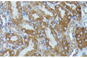 Immunohistochemistry of paraffin-embedded Mouse kidney using TBCB Polyclonal Antibody at dilution of 1:100 (40x lens).
